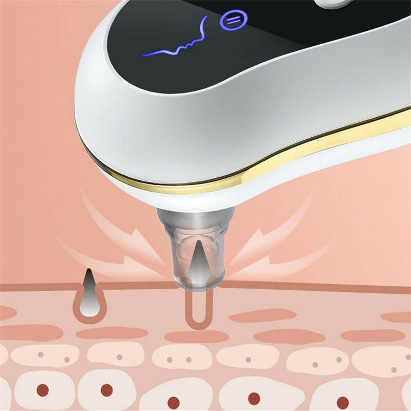 USB Rechargeable Blackhead Remover Vacuum Nose Pore Cleanser Acne Pimple Suction Extractor Skin Care Tool Dropshipping 20#7