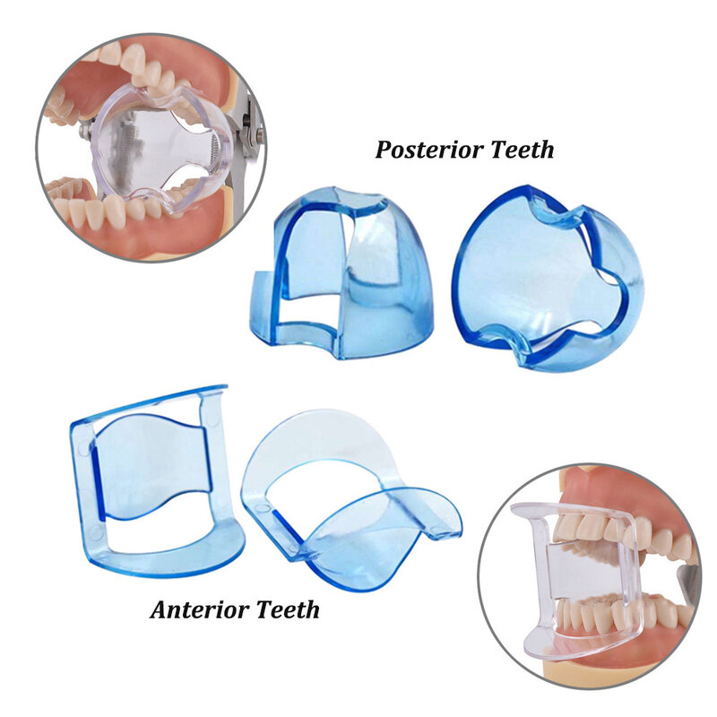 Стоматологический интраоральный Ретрактор для щек, устройство для отбеливания зубов на передних и задних зубах