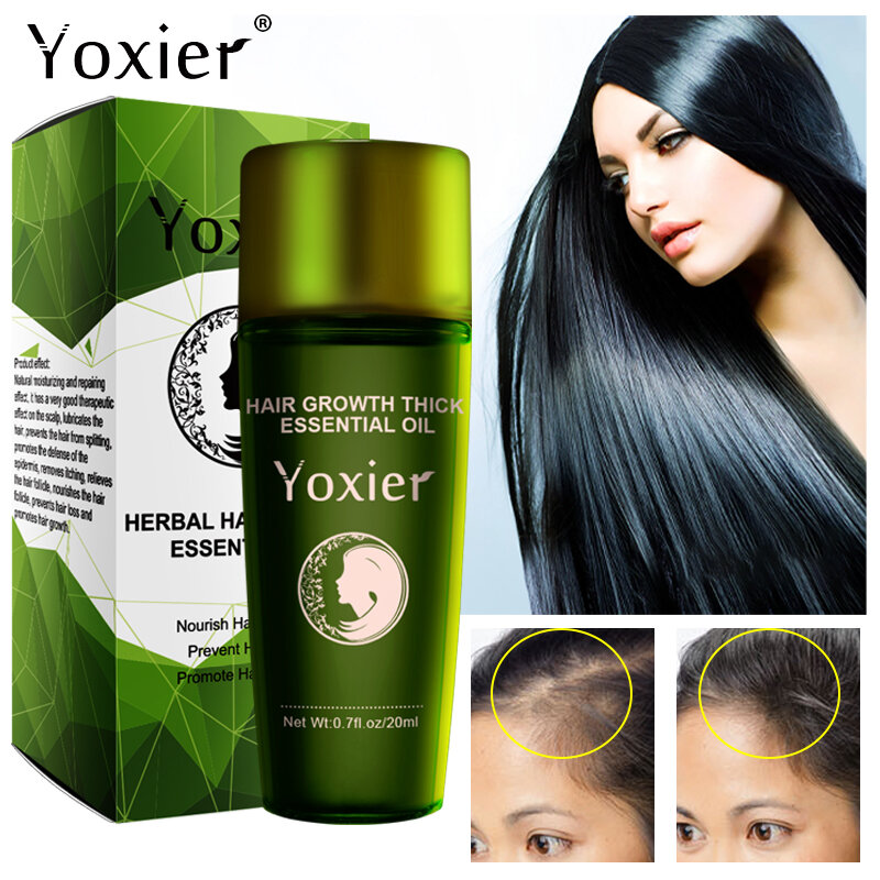 O óleo essencial do crescimento erval do cabelo, promove o crescimento, ativa os folículos capilares, nutrição profunda, impede a perda de cabelo, controla a reparação