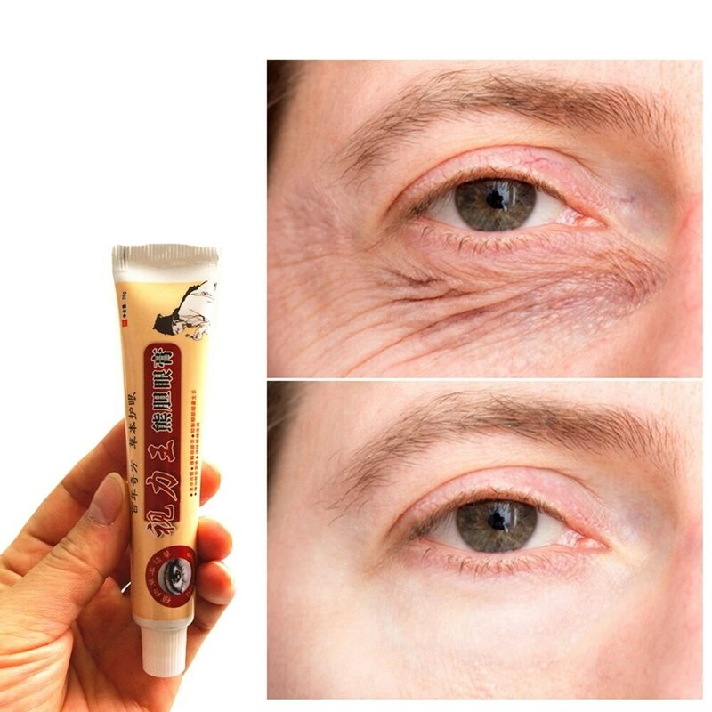 25g/tube Chinese Medicine  Eyes Masks Dark Circle Remover Ointment Lifting Wrinkle Whitening Moisturizing Eye Patches