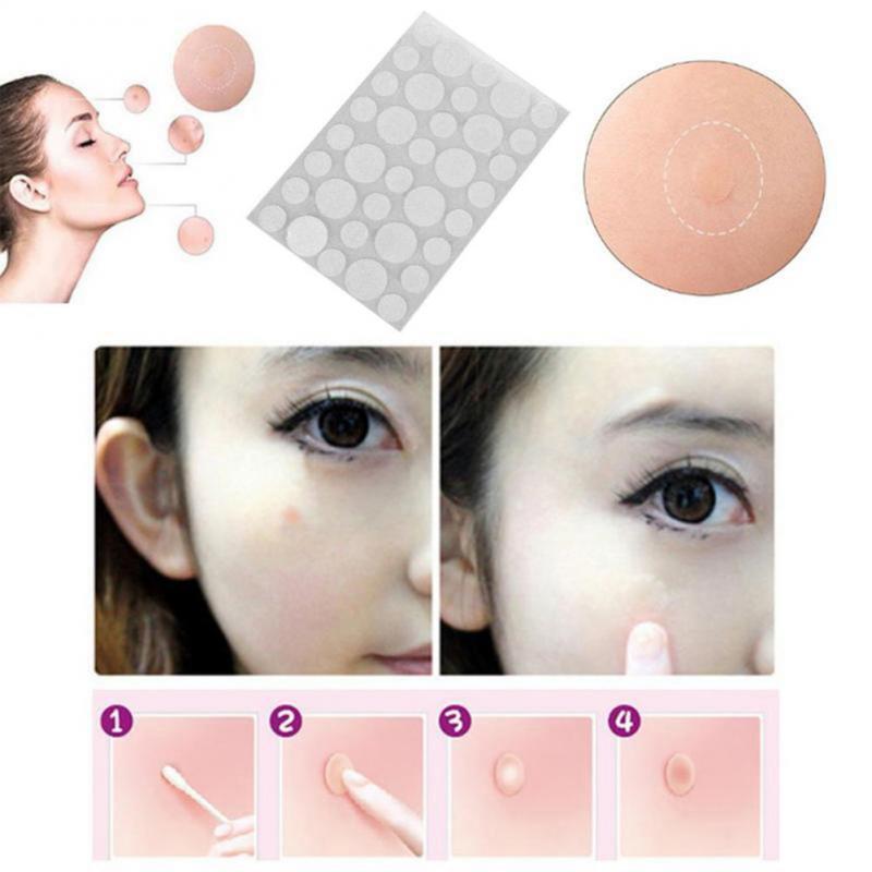 36Pcs Acne brufolo adesivi Patch terapia dell'acne brufolo strumento di rimozione macchia macchia maschera facciale cura della pelle Patch impermeabili Dropship