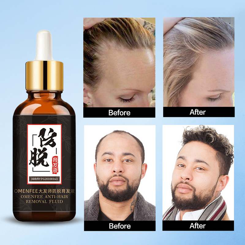 Hair Growth Treatment for Anti Hair Loss Products Beard Oil Repairs Damage Hair Root Hair Tonic Growth Hair Topical Solutions