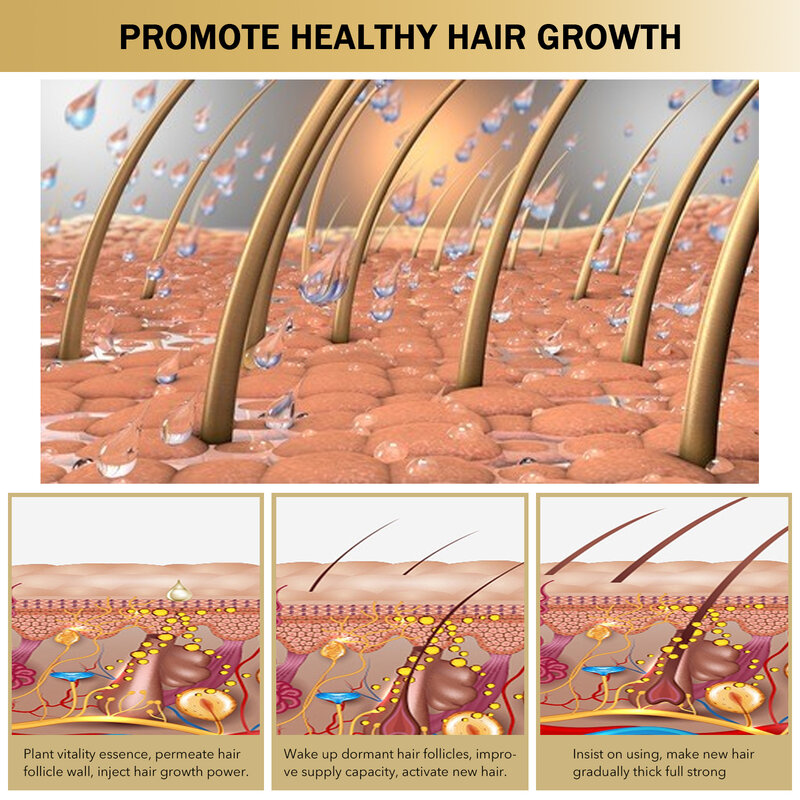 Sérum pour la croissance des cheveux en toute sécurité, produit Anti-perte de cheveux, réparation des racines endommagées, extrait de gingembre, traitement pour la repousse des cheveux, hommes/femmes