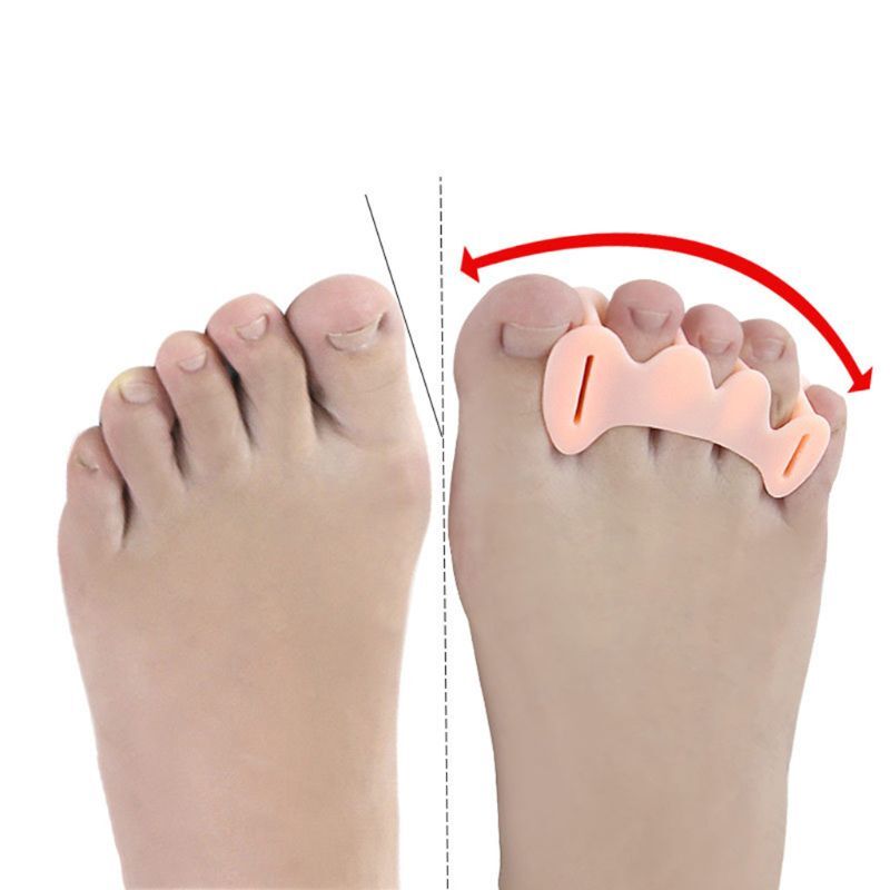 1 pair Hammer Toe Treatment Silicone Three Holes Hallux Valgus Toe Separator Corrector