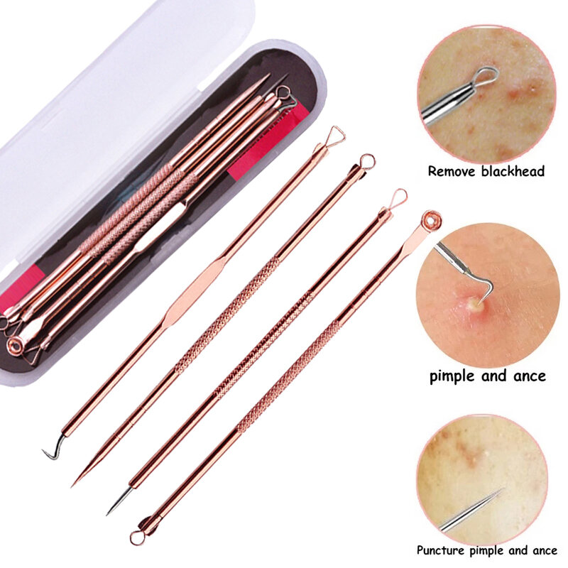 にきび除去針キット,にきびとにきび除去針,フェイシャルスキンケアツール,針クリーナー