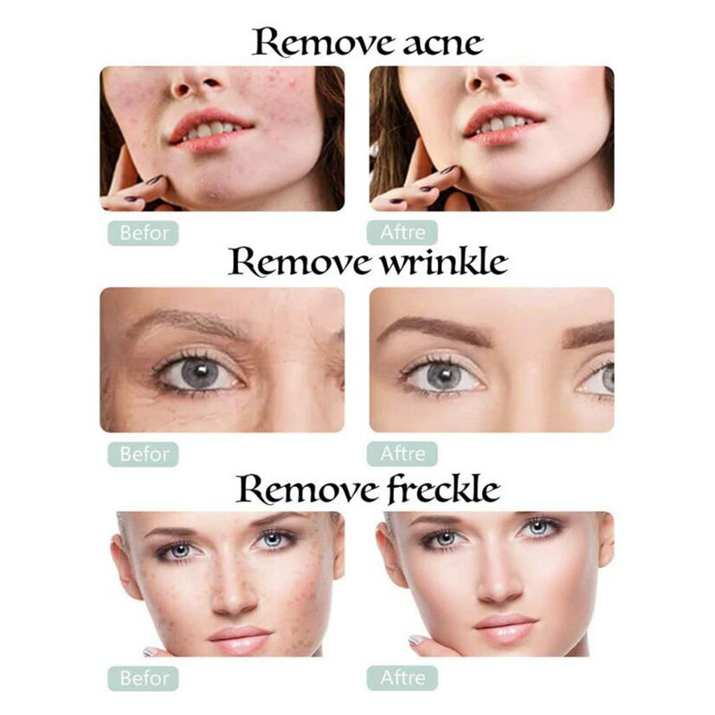 Diamante microdermabrasion dermabrasion máquina esfoliação beleza dispositivos rugas/acne removedor purificador da pele rosto cuidados equipamentos