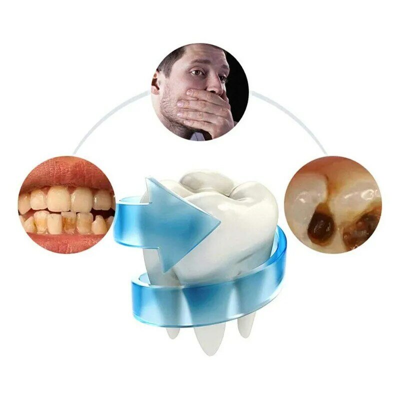 Escova de dentes sônica automática inteligente, sônica, 360 graus, tipo u, carregamento usb, clareamento azul