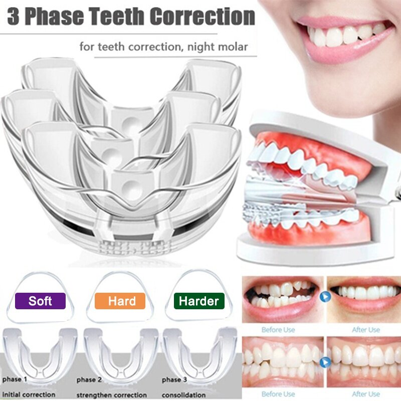 3pcs/set Dental Tooth Orthodontic Appliance Trainer for Alignment Braces 3 Phases Teeth Trainer for Adults Tooth Whitening Tools