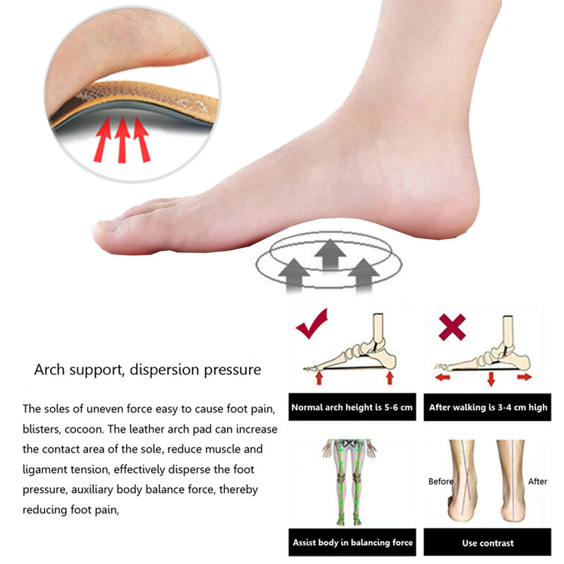 Soletta plantare in pelle per piedi piatti supporto arco scarpe ortopediche solette suola per piedi uomo donna bambini O/X gamba corretta