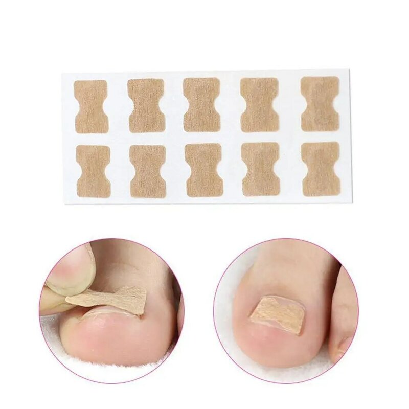 Pegatinas de Corrector de uñas encarnadas para el dedo del pie para tratamiento de Paronychia, herramientas correctoras de pedicura para dedos, pegamento para uñas L2K3