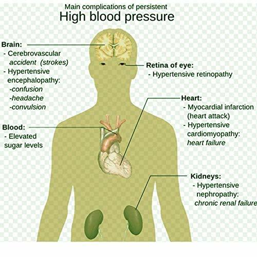 Remendo erval chinês da hipertensão de 100 pces = 50 sacos para o remendo natural da pressão arterial da redução