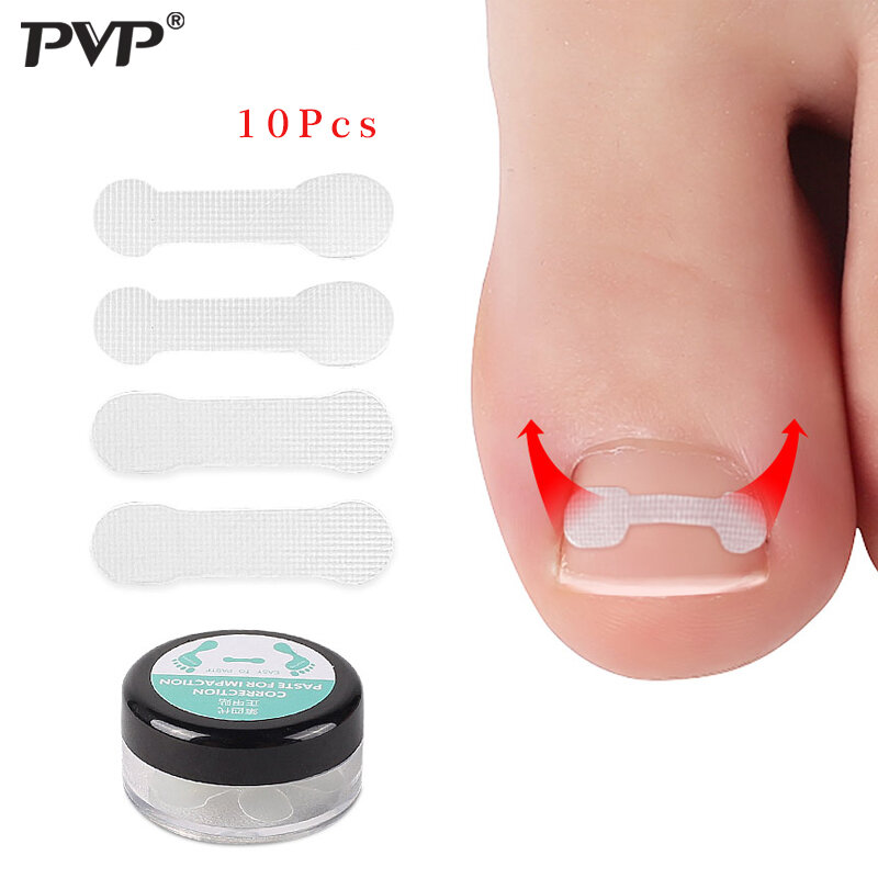 10pcs Ingrown Toenail Correction Tool Ingrown Toe Nail Treatment Elastic Patch Sticker Straightening Clip Brace Pedicure Tool