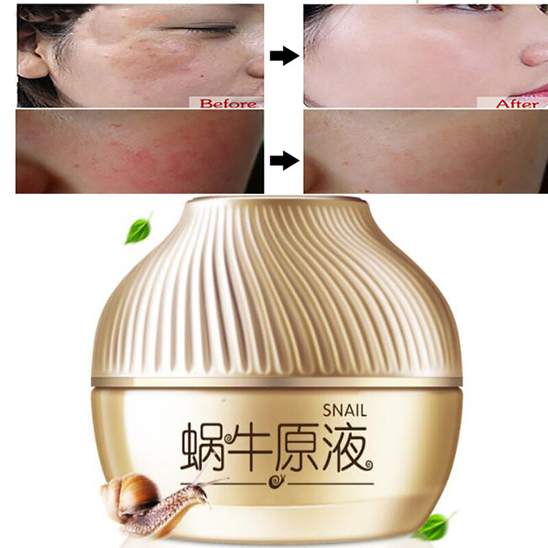 Moisturizing Face Cream Scar Remove Creme Age Spot Pigment Whitening Anti Wrinkle  Beauty Miracle Glow Day  Night