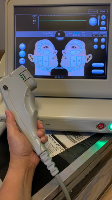 Ultrasonic Anti-Aging กระชับผิวลดริ้วรอยเครื่อง SMAS Lifting Body Sliming Skin Care อุปกรณ์