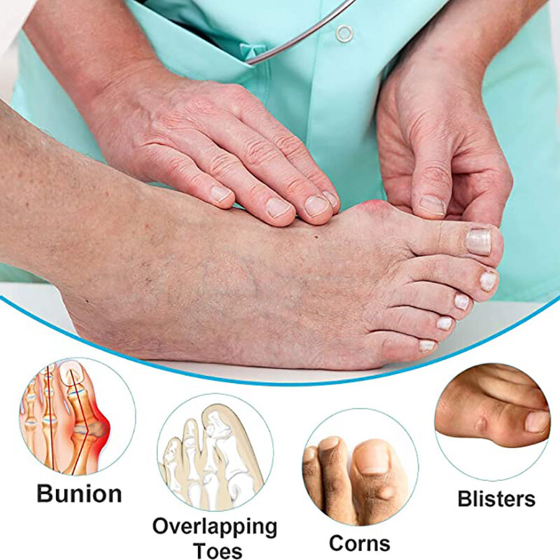 Separador de juanetes para el dedo gordo del pie, Protector de corrección del pulgar, alivio del dolor de los pies, ajustador de hueso del pie, espaciador para el cuidado de los pies, 2 uds.