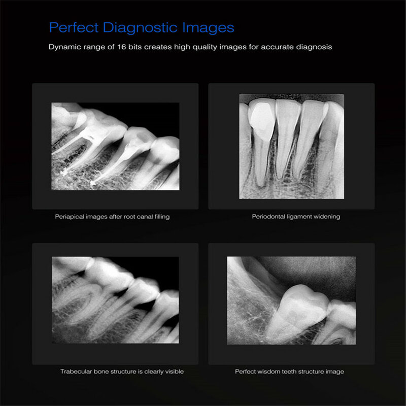 Venda quente digital intra-oral x-ray sensor usb dental dr x ray sensor de imagem rvg x-ray sensor mslfp12