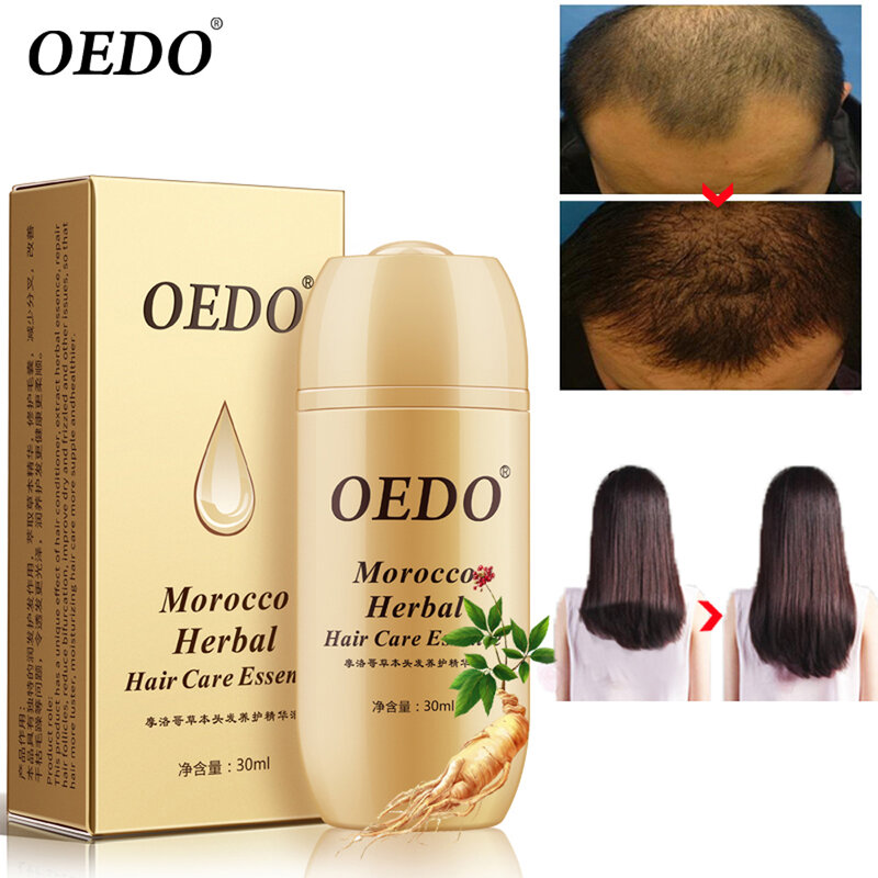 OEDO Morocco Herbal Ginseng Hair Care Essence Treatment For Men And Women Hair Loss Fast Powerful Hair Growth Serum Repair root