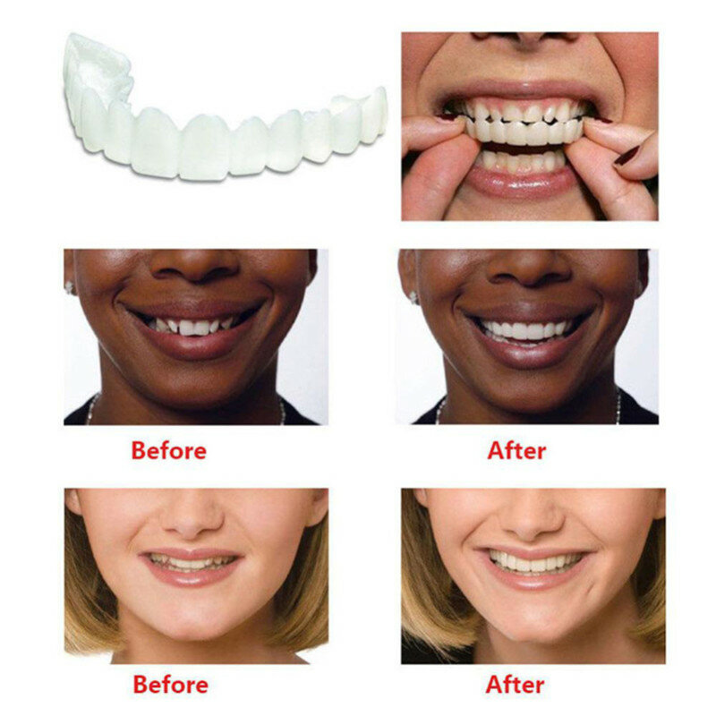Отбеливающая оснастка на улыбке идеальная улыбка подходит для наиболее комфортного ухода за зубными протезами накладные зубные шпоны верх...