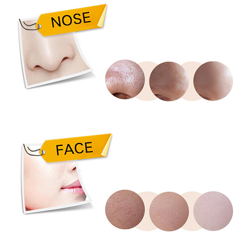 Mascarilla negra Facial salud succión nariz con acné removedor de espinillas Peeling Off cara con espinillas cuidado Mud Facial-35