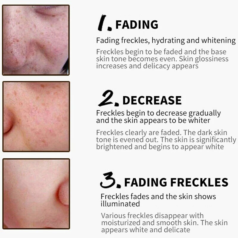 Beacuir creme facial de clareamento de sardas, colágeno, ácido hialurônico, anti-rugas, creme removedor de manchas, cuidados com a pele