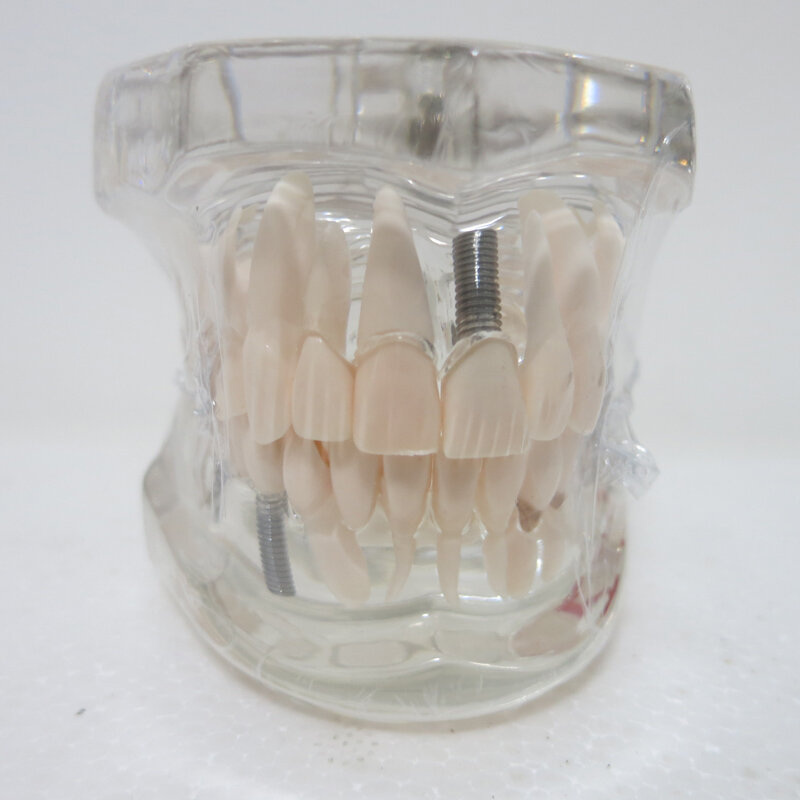Bahan gigi Oral removable dekorasi Klinik gigi patologis model Khusus pribadi dekoratif Patung-patung