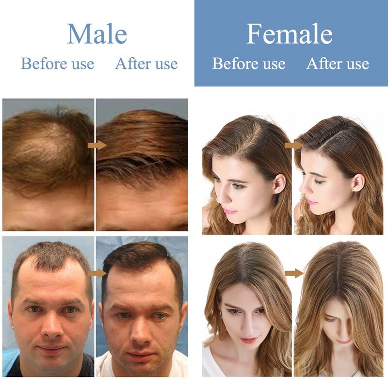 Hair Fiber Spray Hair Building Hairline Powder Fiber Keratin Anti Hair Loss Products Hair Regrowth Powders Hair Additional Fiber