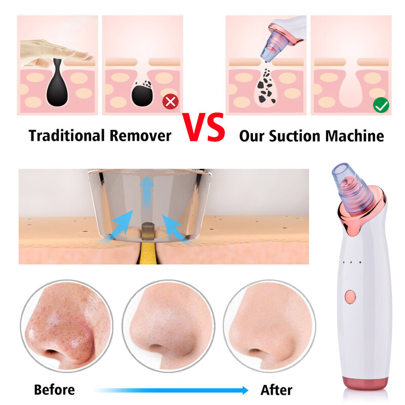 Eliminador de espinillas faciales eléctrico para eliminar puntos negros, limpiador de acné, limpiador de poros al vacío, nariz, herramientas de limpieza profunda