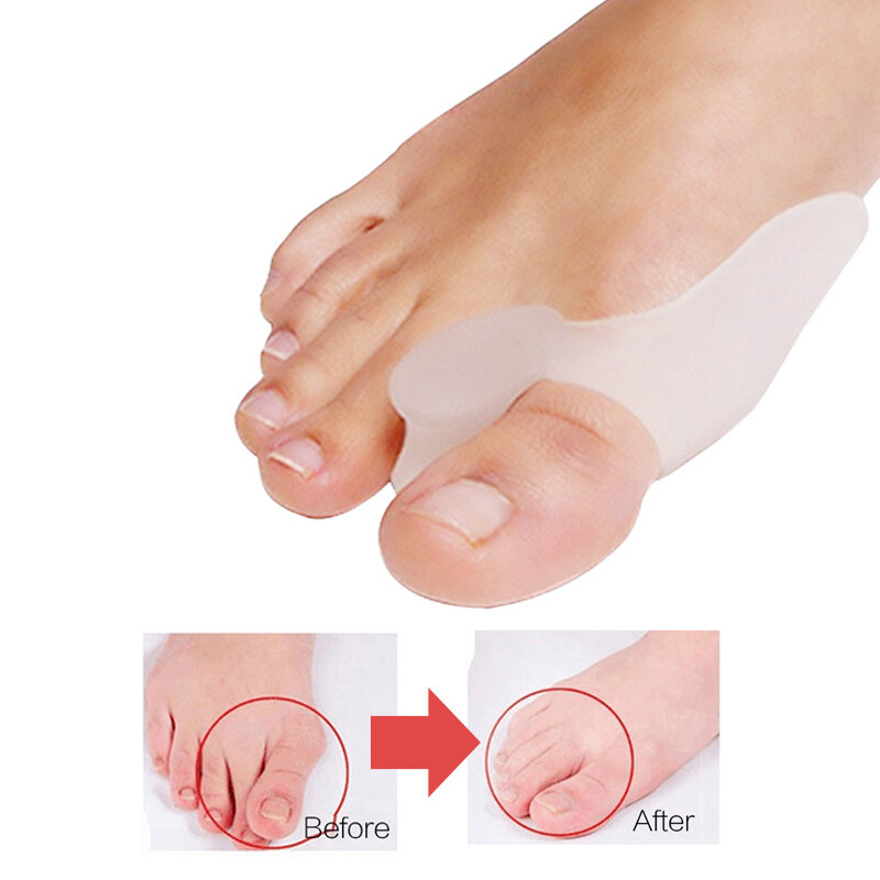 Silicone Gel Bunion Corrector Big Toe Separator Spreader Foot Pain Foot Hallux Valgus Correction Guard Cushion Concealer Thumb