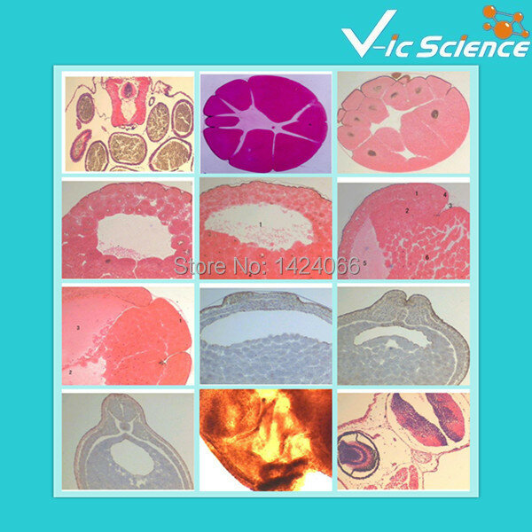 Conjunto de slides preparados embriologia