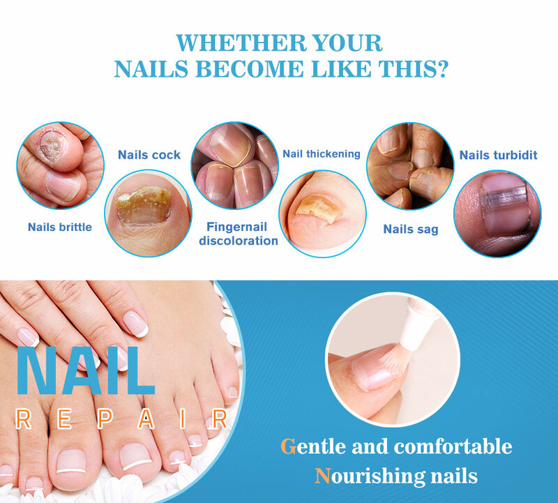 4ML Nail Repair Treatment Liquid Fungus Remover Protective Nail Pen Brush Nail Nourishing Brightening Hand Foot Care  TSLM2