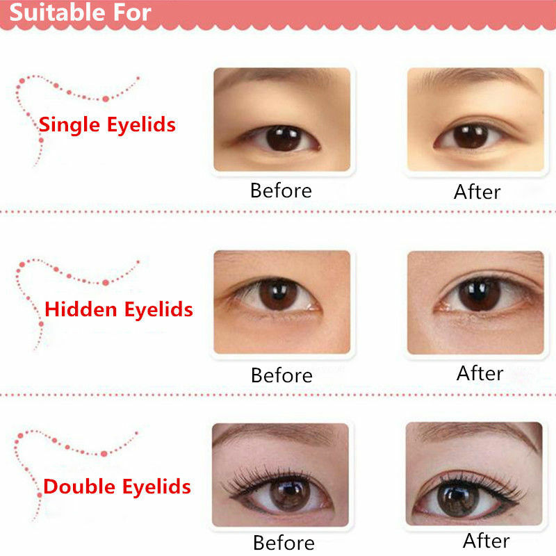 Adomaner 260 Pieces Narrow Eyelid Paste Super Invisible Double Eyelid Sticker Tape Technical Eye Tapes For Makeup Tools Hot Sale