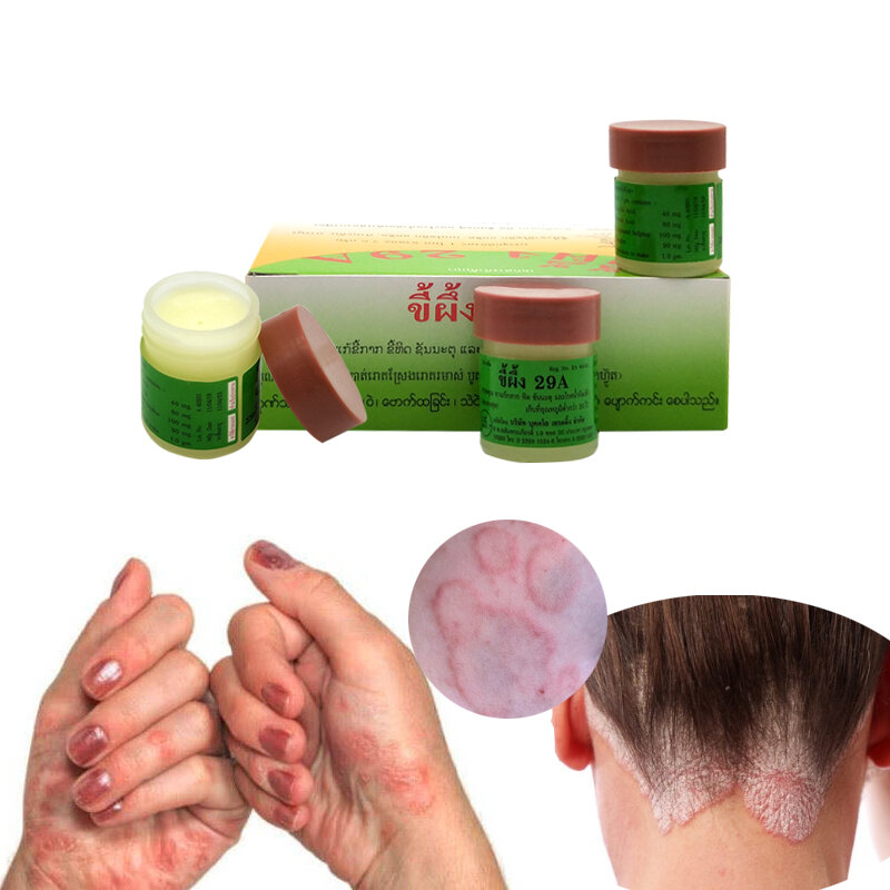 Dropshipping zudaifu pele psoríase creme dermatite eczematoid eczema pomada tratamento psoríase creme yiganerjing