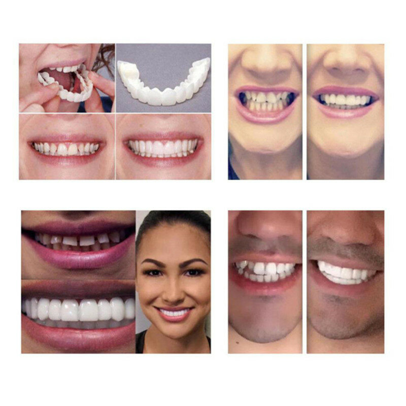 Blanchiment pression sur sourire sourire parfait s'adapte à la plupart des soins de prothèse dentaire confortables faux placages de dents dentaires supérieures et dents inférieures