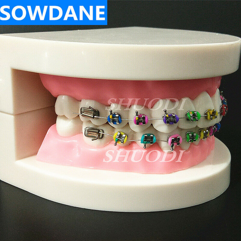 Modelo de tratamiento de ortodoncia Dental con soporte de Metal Orto, alambre de arco, Ligadura de tubo bucal, modelo de dientes