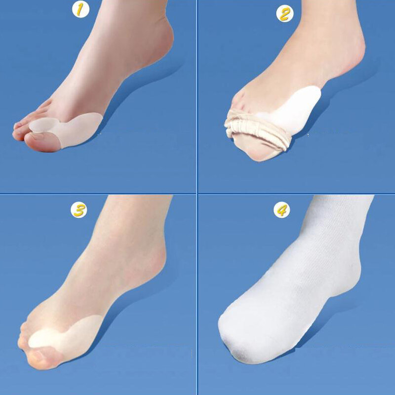 Sumifun 2Pcs Silicone Gel Bunion Splint Big Toe Separator Overlapping Spreader Corrector Hallux Valgus Foot Massager C147