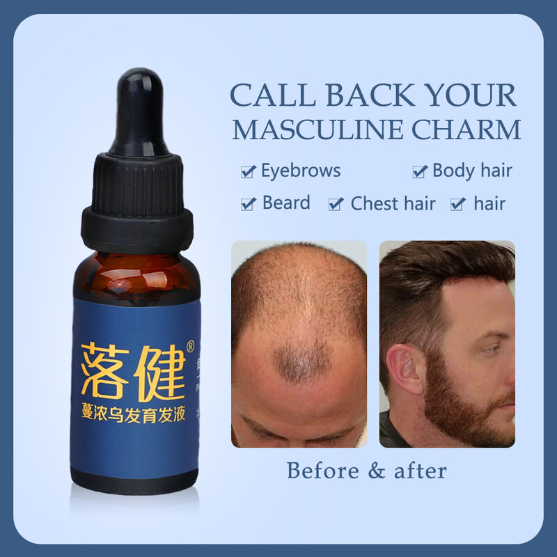 Anti Hair Loss Products Hair Growth for Growth Hair Oil  Treatment Genger Essence Oil Stimulation Fast Thick Hair Care Solutions