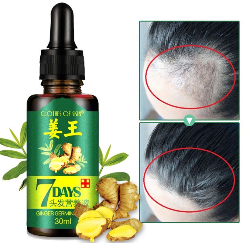 7 Days Ginger Essence Hairdressing Hairs Mask Hair Essential Oil Dry and Damaged Hairs Nutrition Wholesale