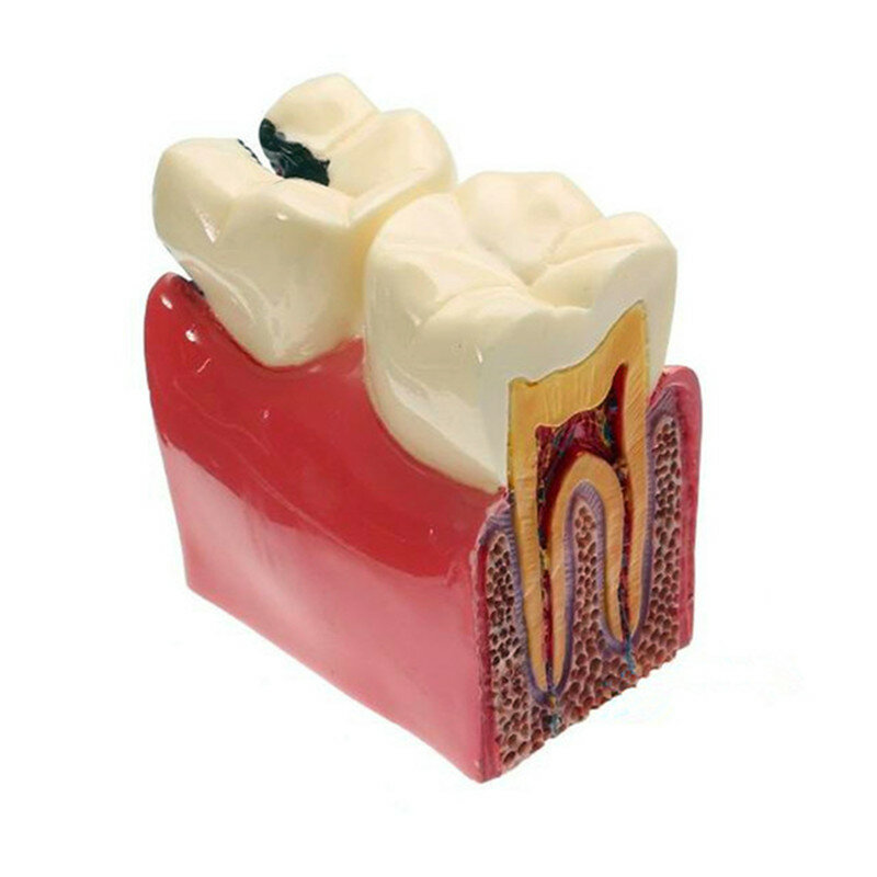 Varios modelos de dientes dentales se utilizan para la enseñanza y Material de dentista hospitalario