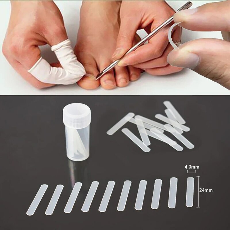 Hot Ingrown Toenail Correction Tool Ingrown Toe Nail Treatment Elastic Patch Sticker Straightening Clip Brace Pedicure Tool