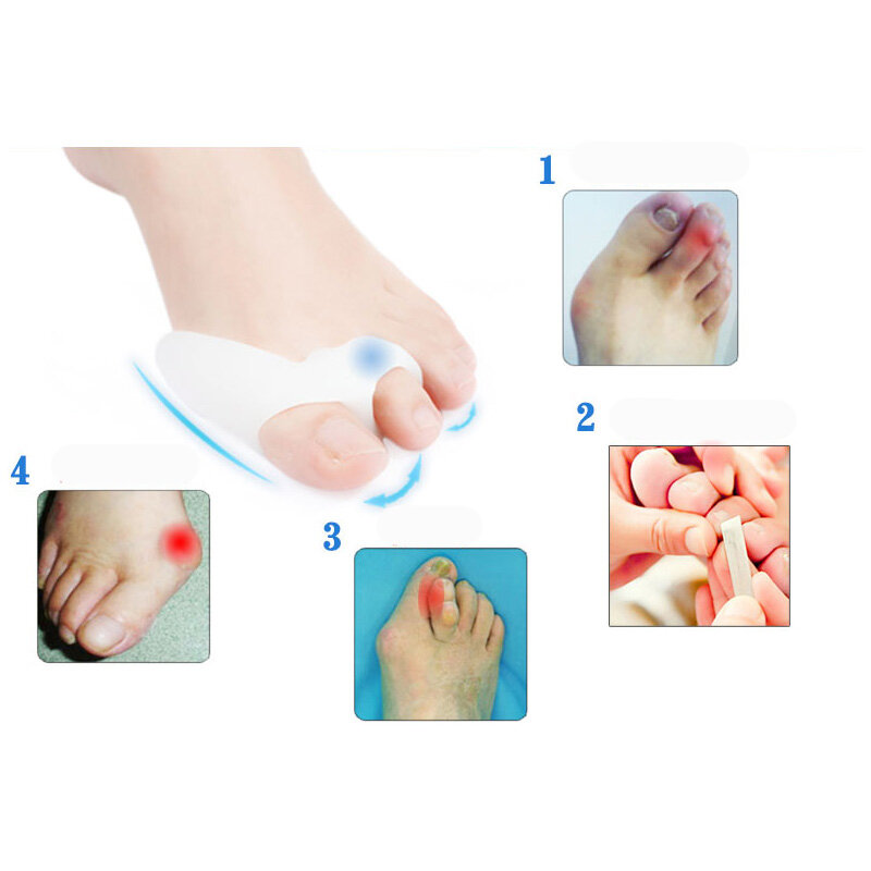 2Pcs Pedicure คอนซีลเลอร์สำหรับนิ้วเท้าเจลเท้า Stretchers Bunion Protector Straightener Bunion Corrector Foot Care Hallux Valgus