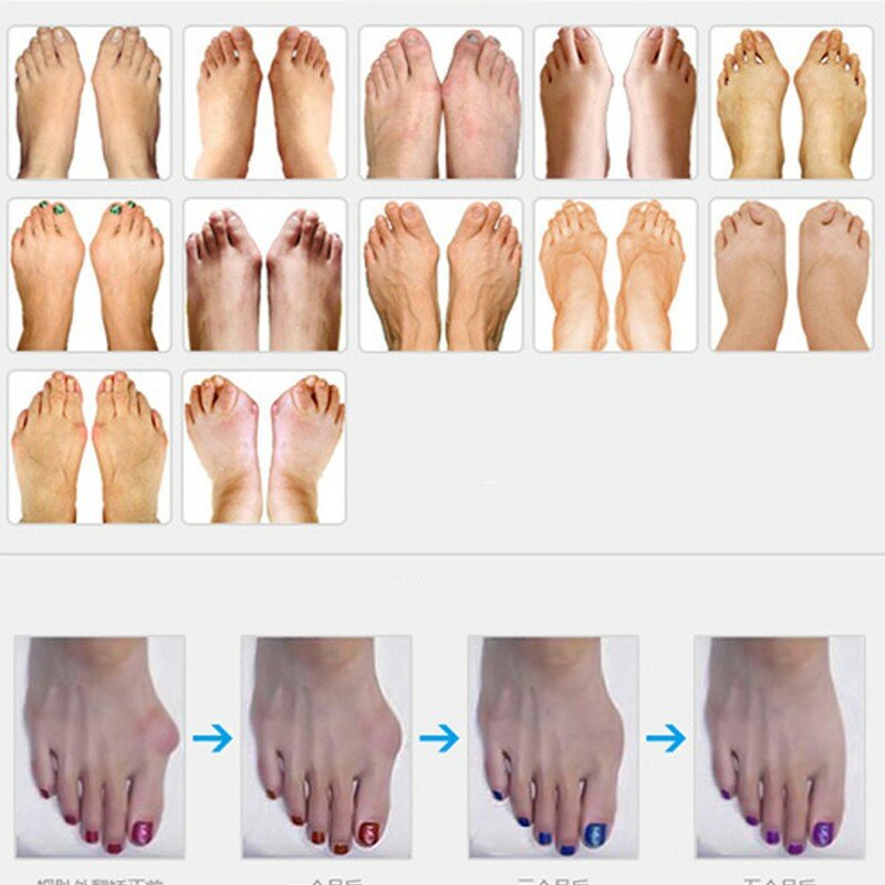 2pcs=1pair Hallux Valgus Silicone Corrector Gel Foot Care Toe Separator Little Finger Protector Bunion Straightener Pedicure