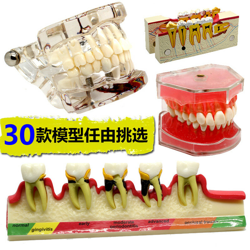 Varios modelos de dientes dentales se utilizan para la enseñanza y Material de dentista hospitalario