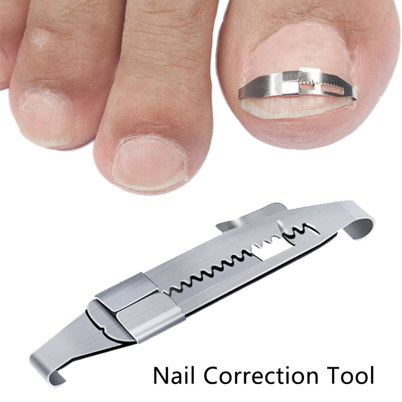 Wrastające Toe narzędzie do korekcji paznokci paznokieć prostowanie korektory łatka narzędzie klip do prostowania Brace narzędzie do Pedicure