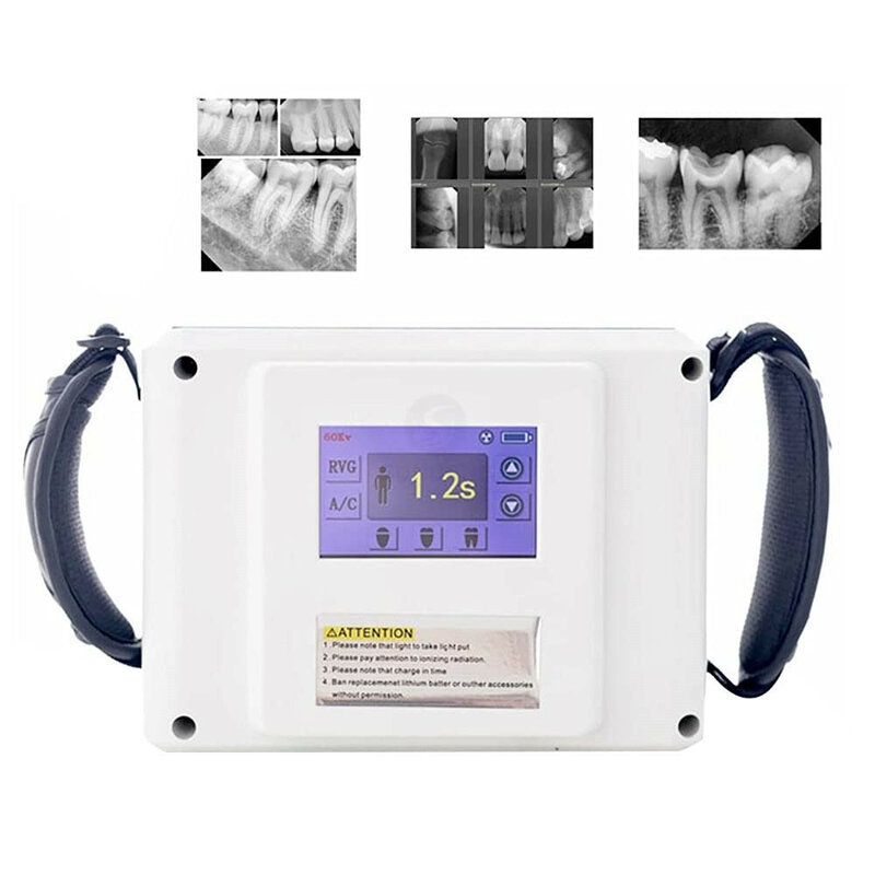 Good Touch Screen Dental X Ray Camera Unit/High Frequency Dental x-ray machine portable /Dental Imaging System Supplier