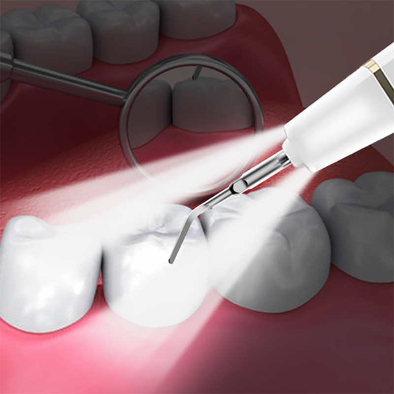 جهاز تنظيف الأسنان بالموجات فوق الصوتية آلة تنظيف الأسنان آلة كهربائية منزلية لإزالة التفاضل والتكامل وإزالة الذوبان