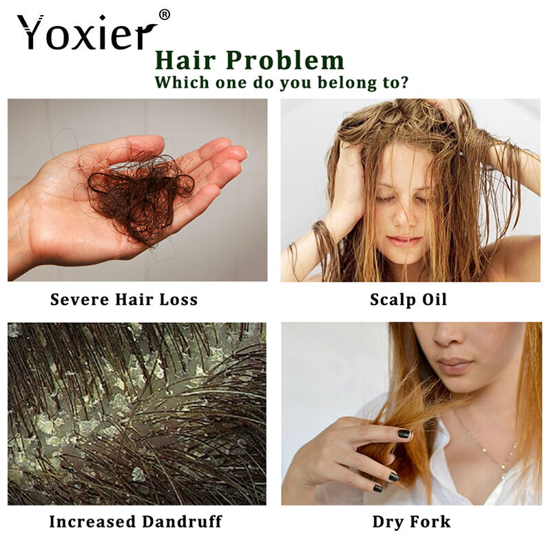 O óleo essencial do crescimento erval do cabelo, promove o crescimento, ativa os folículos capilares, nutrição profunda, impede a perda de cabelo, controla a reparação