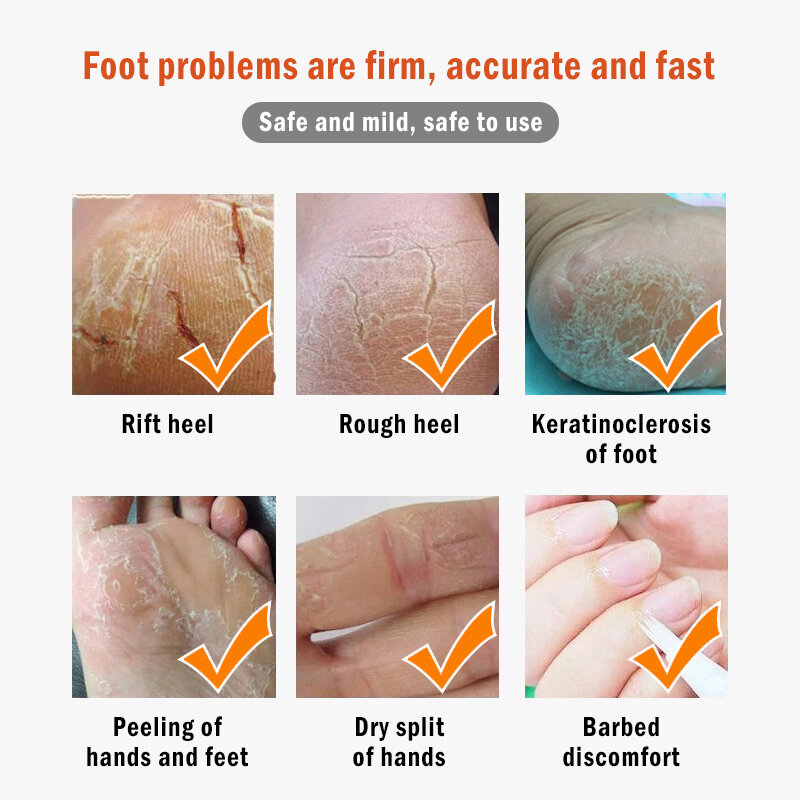 Natural Banana Oil Anti-Drying Crack Foot Cream Heel Cracked Repair Cream Removal Dead Skin Hand Feet Care Dropship TSLM1