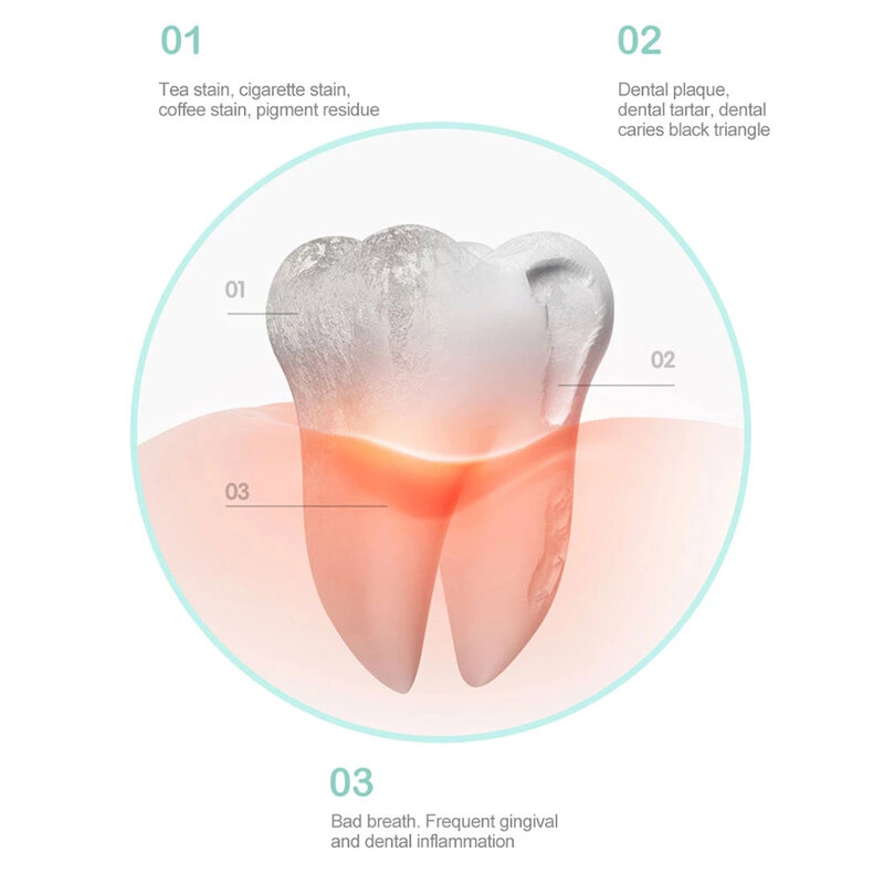 Ultra sonic Electric Sonic Dental whitener skaler zestaw do wybielania zębów kamień nazębny Remover narzędzia Cleaner ząb Stain pielęgnacja jamy ustnej