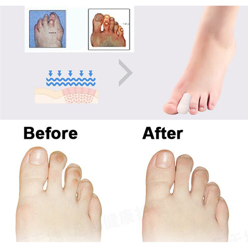 Soft Silicone Tube Toe Protector, Foot Corn Blisters, Calos Proteção Pad, Bunion Finger Pain Relief Massager Tool, 3 Pares, 6Pcs