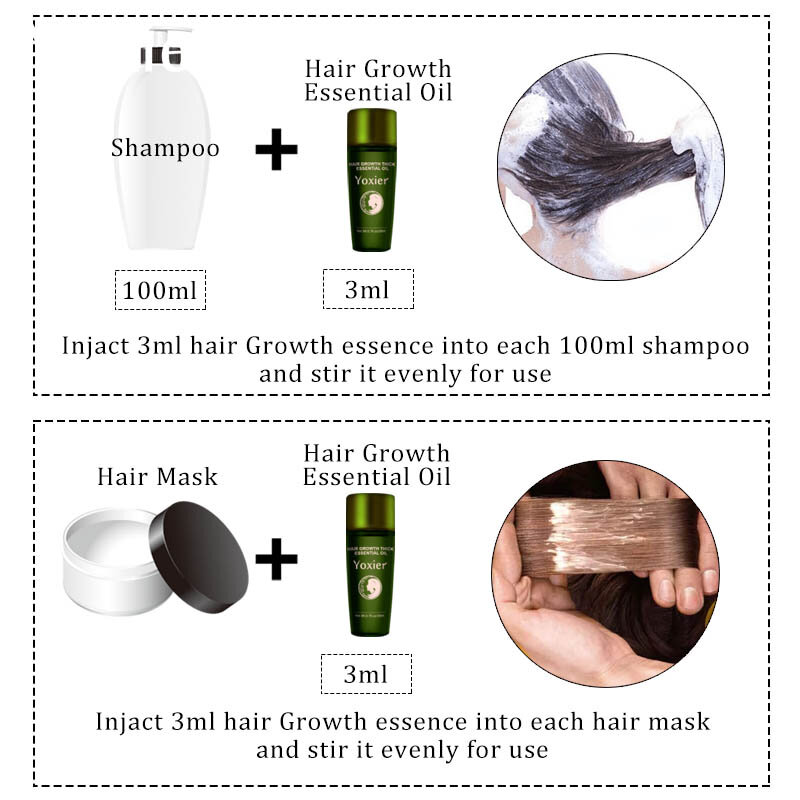 Yoxier 3 قطعة نمو الشعر جوهر النفط استخراج فعال مكافحة تغذية جذور الشعر العلاج منع تساقط الشعر منتجات العناية بالشعر